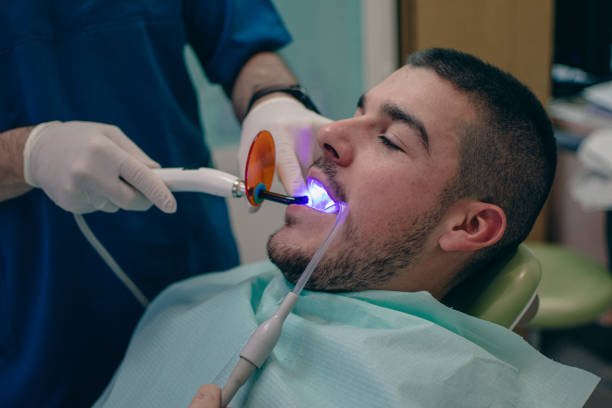 bonding the filling to the tooth with a polymerization lamp at the dentist bonding the filling to the tooth with a polymerization lamp at the dentist